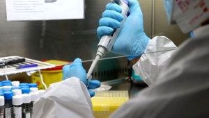 ABD'de yeni bir ölümcül salgın ortaya çıktı