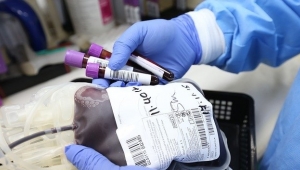 "İmmün plazma bağışı yapmak için bizi arayın"