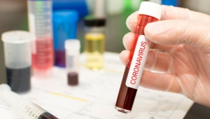 Koronavirüs tedavisinde kullanılacak yerli ilaca satış izni çıktı