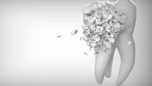 Koronavirüs pandemisinde diş sağlığınızdan olmayın