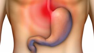 Reflü nedir, reflü belirtileri nelerdir? Reflü kansere yol açar mı?