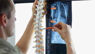 Skolyoz hastalığı nedir, nasıl tedavi edilir?