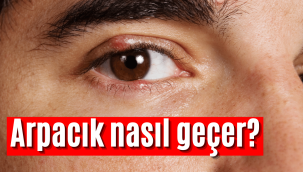 Arpacık nasıl geçer, gözde arpacık neden çıkar, nasıl tedavi edilir doğal bitkisel yöntem!