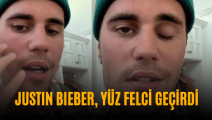 Ramsay Hunt Sendromu nedir? Justin Bieber'in hastalığı nedir, ne oldu? 