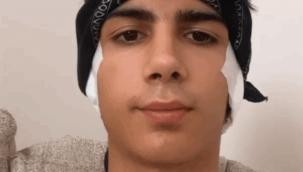 Taha Duymaz'ın kulak ameliyatı sonrası son hali!