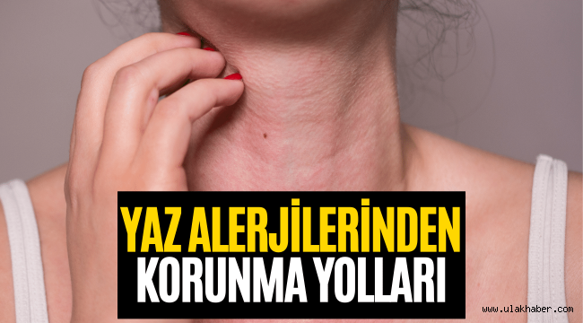 Yazın deniz, havuz ve güneş alerjilerinden korunma yöntemleri nelerdir?