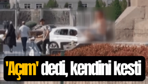 Kayseri'de aç olduğunu söyleyen bir vatandaş kendini kesti